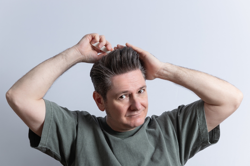 Portrait,Of,A,Man,In,His,50's,In,Casual,Dress Haarverlies bij mannen